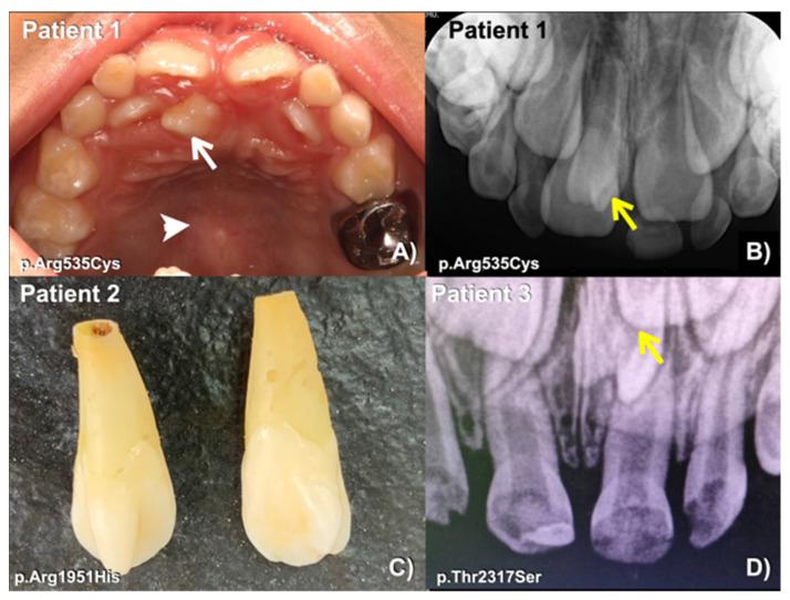 https://cdn.ncbi.nlm.nih.gov/pmc/blobs/4b67/10093539/5b5c583ae2c9/diagnostics-13-01214-g002.jpg