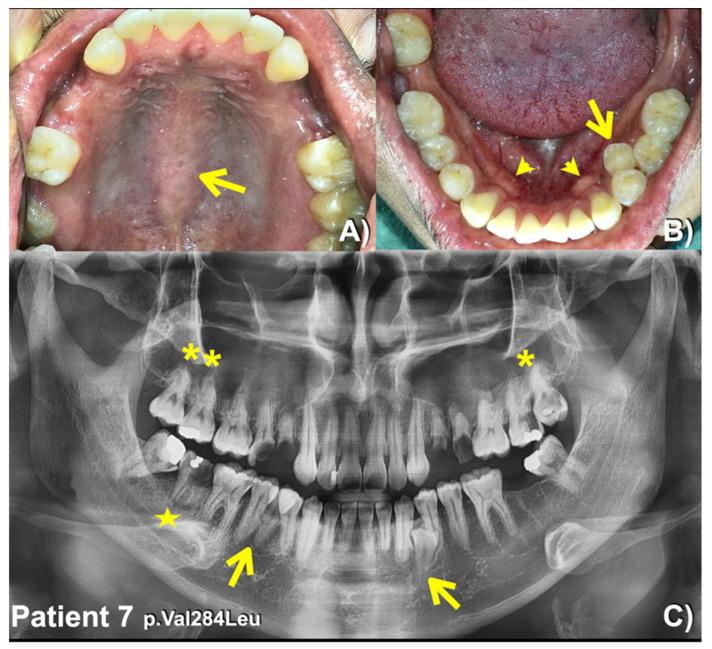 https://cdn.ncbi.nlm.nih.gov/pmc/blobs/4b67/10093539/ca537281d824/diagnostics-13-01214-g005.jpg