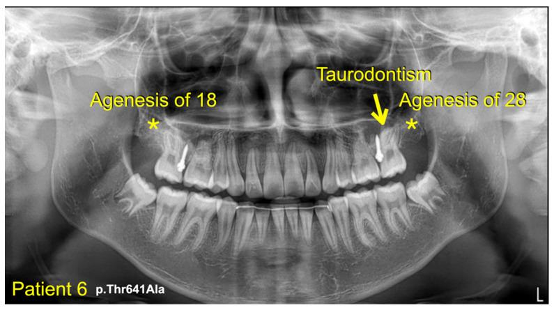 https://cdn.ncbi.nlm.nih.gov/pmc/blobs/4b67/10093539/e7b83dc61225/diagnostics-13-01214-g004.jpg