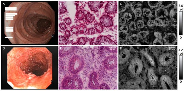 https://cdn.ncbi.nlm.nih.gov/pmc/blobs/4b6b/10299047/9717b3ae535e/jcm-12-04067-g002.jpg