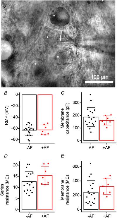 https://cdn.ncbi.nlm.nih.gov/pmc/blobs/4b6e/11955863/8da8feb47ade/TJP-603-1923-g004.jpg