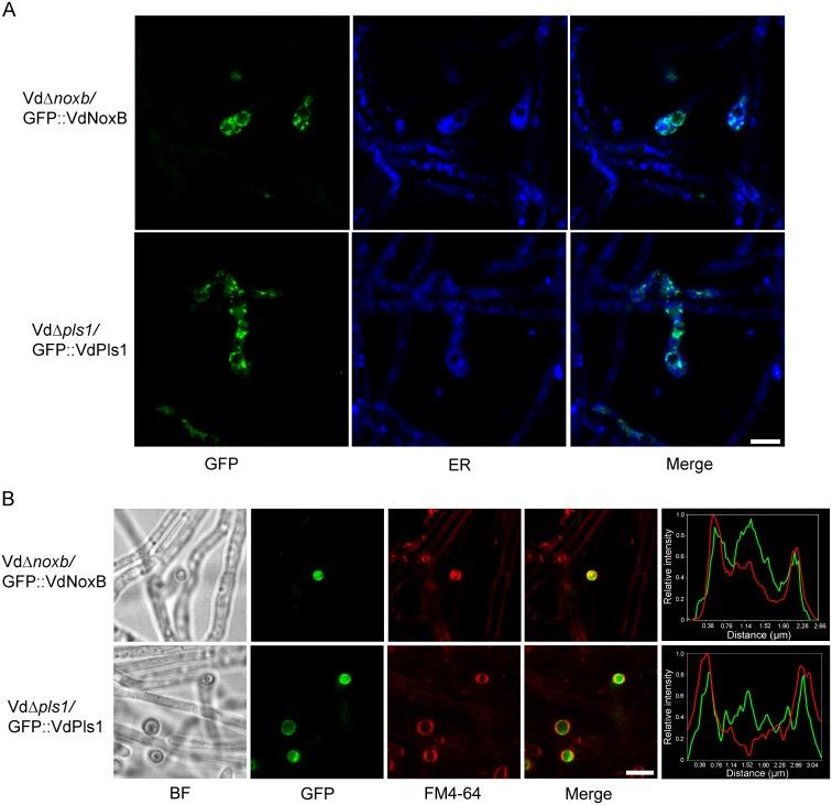 https://cdn.ncbi.nlm.nih.gov/pmc/blobs/4b78/4962994/7750aa64734a/ppat.1005793.g004.jpg