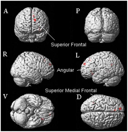 https://cdn.ncbi.nlm.nih.gov/pmc/blobs/4b86/2928271/8b25b053fe22/pone.0012291.g004.jpg