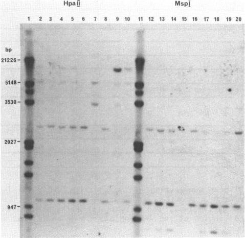 https://cdn.ncbi.nlm.nih.gov/pmc/blobs/4b8a/341338/2150ccf2e5ee/nar00293-0292-a.jpg