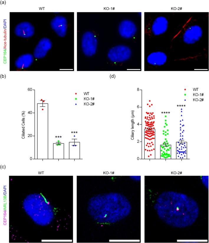 https://cdn.ncbi.nlm.nih.gov/pmc/blobs/4b8d/12078756/25fe538ffb82/JCLA-39-e70000-g004.jpg