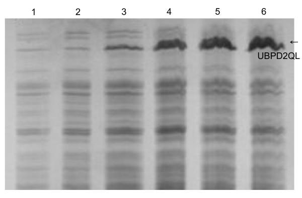 https://cdn.ncbi.nlm.nih.gov/pmc/blobs/4b8e/1156937/5009487a278f/1475-2859-4-17-2.jpg