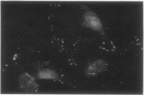 https://cdn.ncbi.nlm.nih.gov/pmc/blobs/4b8e/48491/92549944dbab/pnas01079-0050-a.jpg