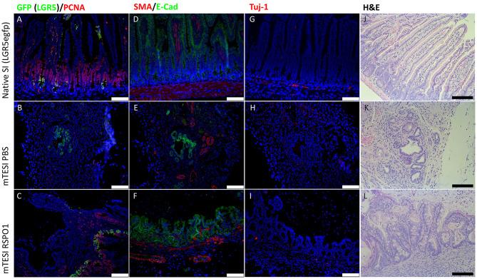 https://cdn.ncbi.nlm.nih.gov/pmc/blobs/4b94/7295003/30cab73f640e/fbioe-08-00476-g0006.jpg