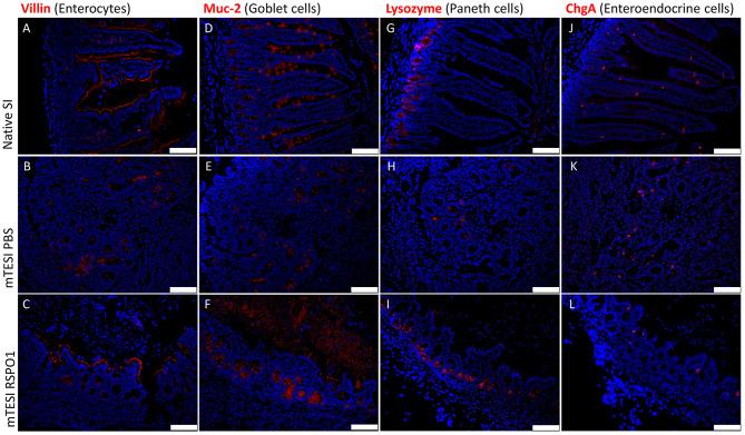 https://cdn.ncbi.nlm.nih.gov/pmc/blobs/4b94/7295003/c1de50d96ba3/fbioe-08-00476-g0005.jpg