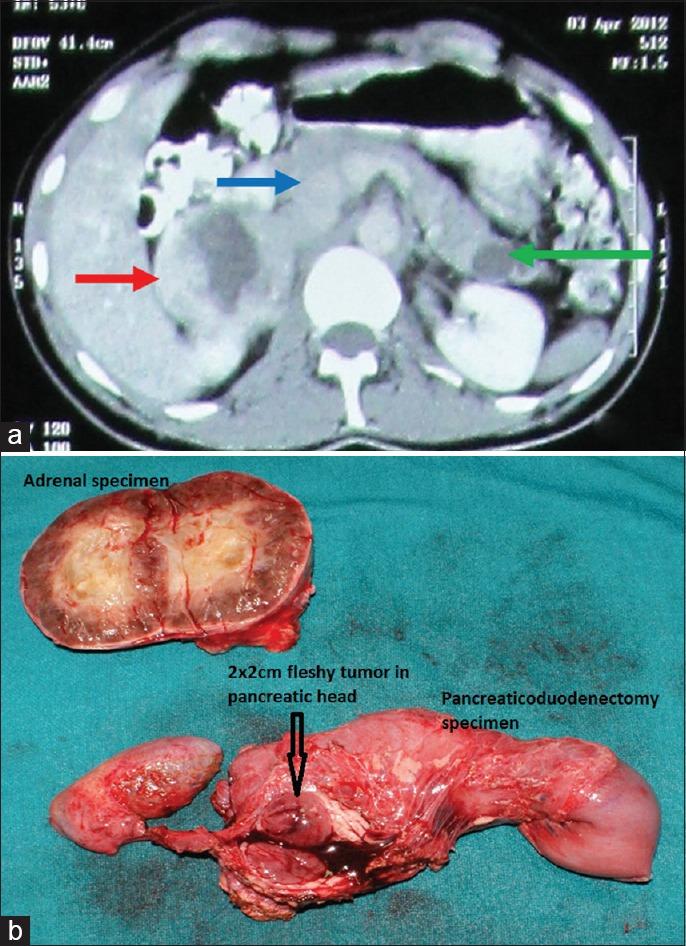 https://cdn.ncbi.nlm.nih.gov/pmc/blobs/4b98/6446673/4b92201010bb/IJEM-23-159-g002.jpg