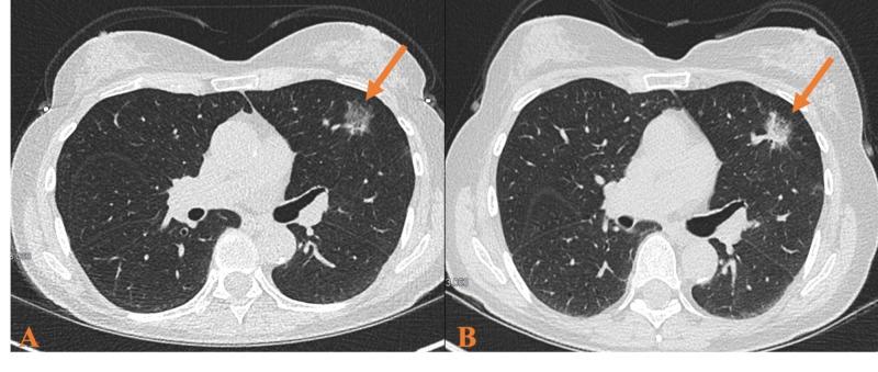 https://cdn.ncbi.nlm.nih.gov/pmc/blobs/4b9a/6894895/023d02a9f18a/cureus-0011-00000006079-i02.jpg