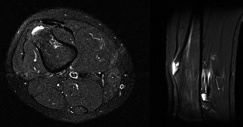 https://cdn.ncbi.nlm.nih.gov/pmc/blobs/4b9c/8355958/1eab7f1f8329/CRIOR2021-5533636.008.jpg