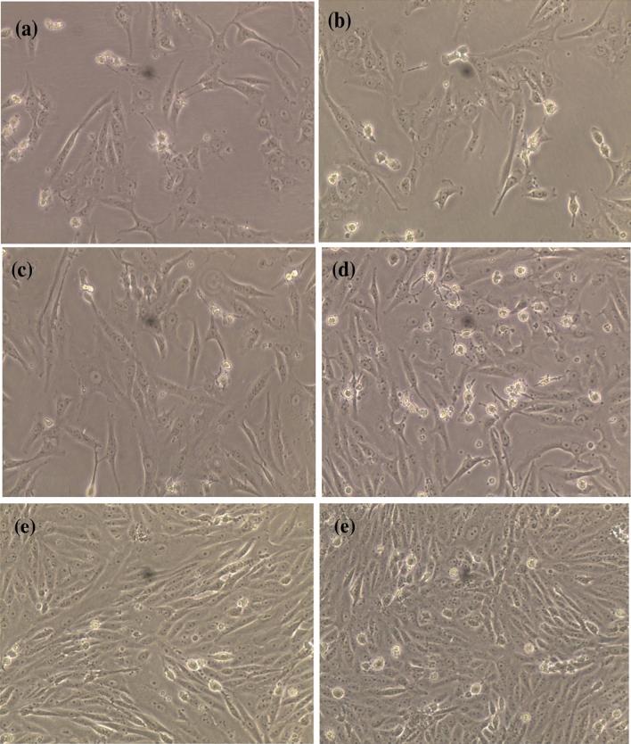 https://cdn.ncbi.nlm.nih.gov/pmc/blobs/4ba1/8844081/35b1f574dda0/41598_2022_6412_Fig12_HTML.jpg