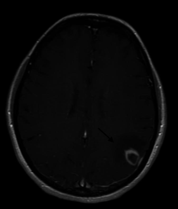https://cdn.ncbi.nlm.nih.gov/pmc/blobs/4ba1/9840453/a52aa4a62394/cureus-0014-00000032567-i01.jpg