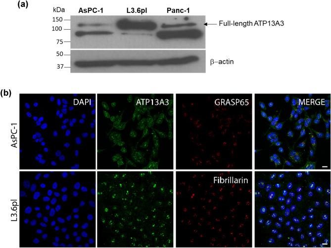 https://cdn.ncbi.nlm.nih.gov/pmc/blobs/4bac/8904813/b8be38cb285b/41598_2022_7712_Fig1_HTML.jpg