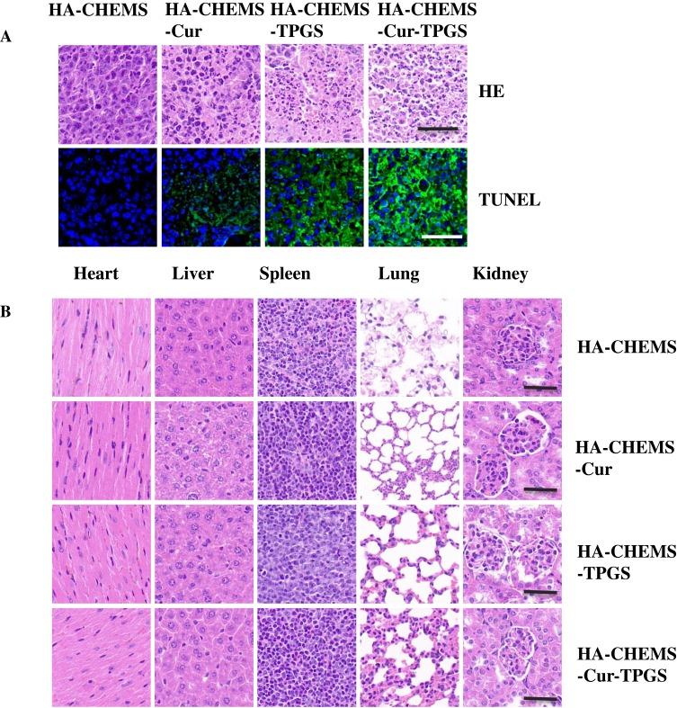https://cdn.ncbi.nlm.nih.gov/pmc/blobs/4bb0/7200226/8e96e5c8d3e1/IJN-15-2987-g0007.jpg