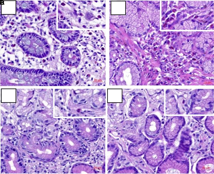 https://cdn.ncbi.nlm.nih.gov/pmc/blobs/4bb1/10441091/021af0e209a0/tjg-34-6-593_f002.jpg