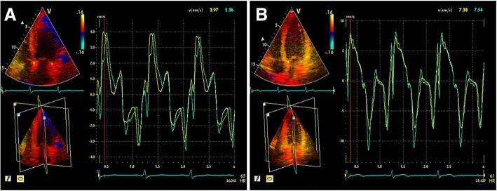https://cdn.ncbi.nlm.nih.gov/pmc/blobs/4bb2/6167824/38bd61a29270/12947_2018_142_Fig1_HTML.jpg