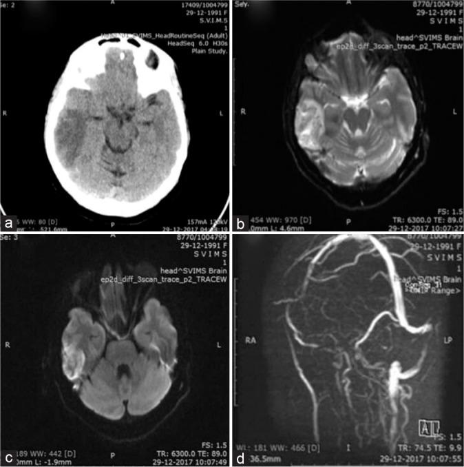 https://cdn.ncbi.nlm.nih.gov/pmc/blobs/4bb7/10483190/d745cf5aab81/JNRP-14-418-g002.jpg