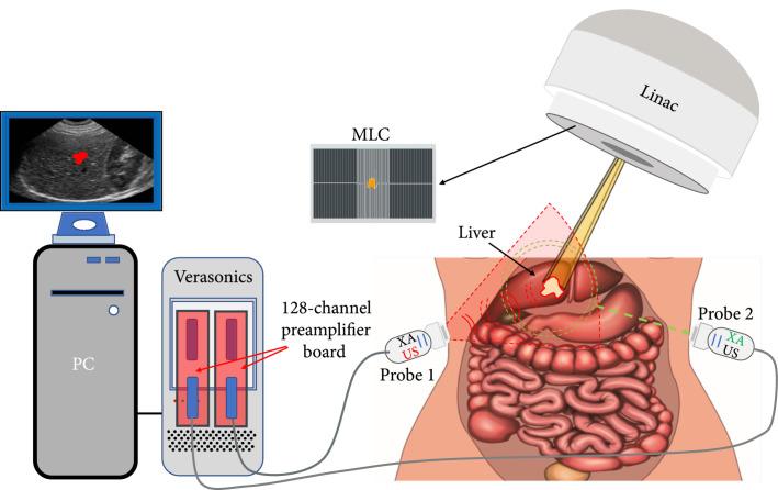 https://cdn.ncbi.nlm.nih.gov/pmc/blobs/4bb7/10521688/650a2c1d52df/9853609.fig.001.jpg