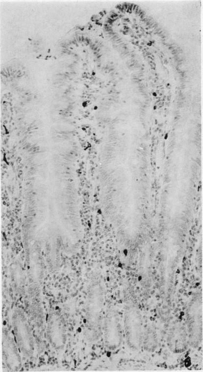 https://cdn.ncbi.nlm.nih.gov/pmc/blobs/4bc8/493957/310fe52b5102/jclinpath00489-0035-a.jpg