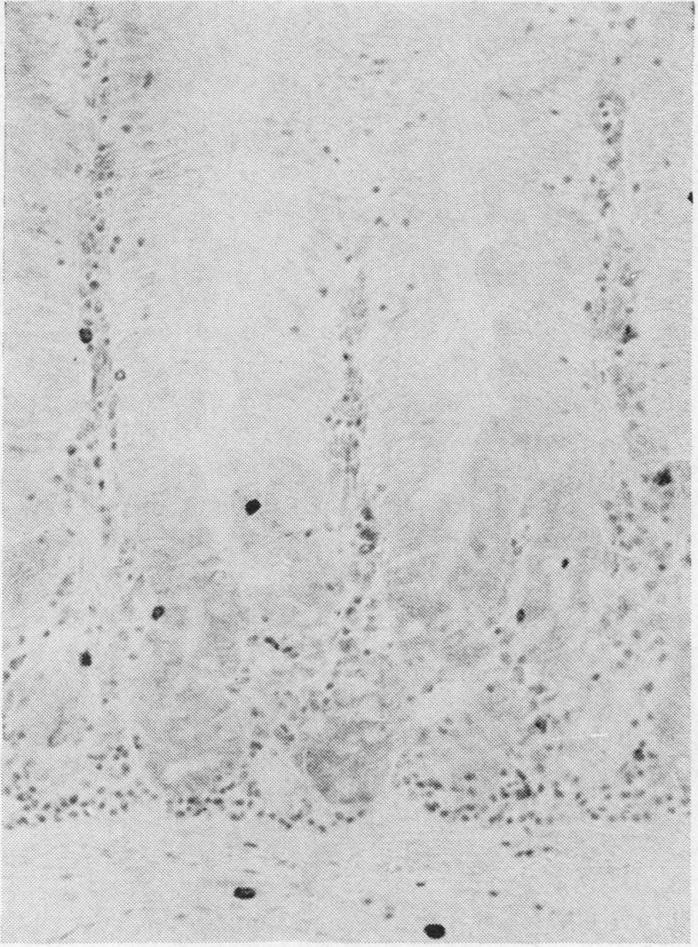 https://cdn.ncbi.nlm.nih.gov/pmc/blobs/4bc8/493957/4652b6c5f1e7/jclinpath00489-0036-c.jpg