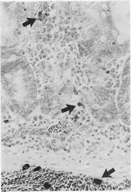 https://cdn.ncbi.nlm.nih.gov/pmc/blobs/4bc8/493957/751a066e8012/jclinpath00489-0037-a.jpg