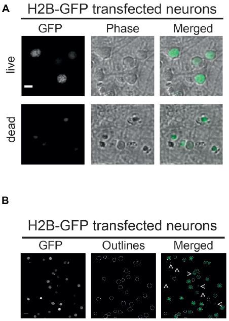 https://cdn.ncbi.nlm.nih.gov/pmc/blobs/4bcb/6224347/58d9b8bb5cb1/fnmol-11-00393-g0002.jpg