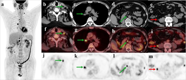 https://cdn.ncbi.nlm.nih.gov/pmc/blobs/4bcf/7908760/8d14a004a4b7/40644_2021_393_Fig4_HTML.jpg