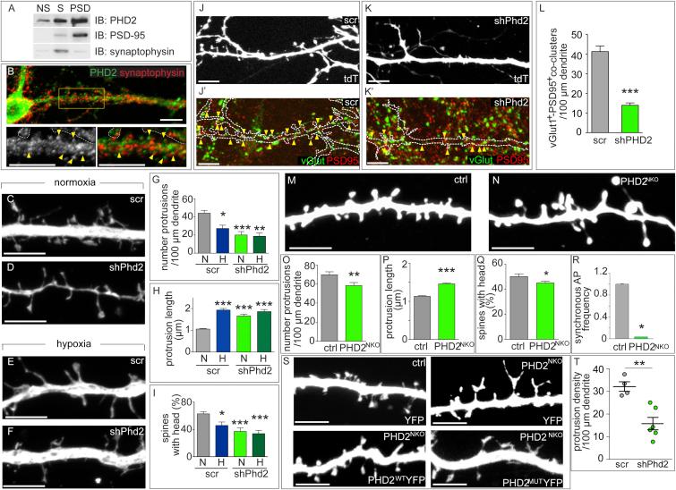 https://cdn.ncbi.nlm.nih.gov/pmc/blobs/4bd8/4805856/79c0cdf8ffe7/gr3.jpg