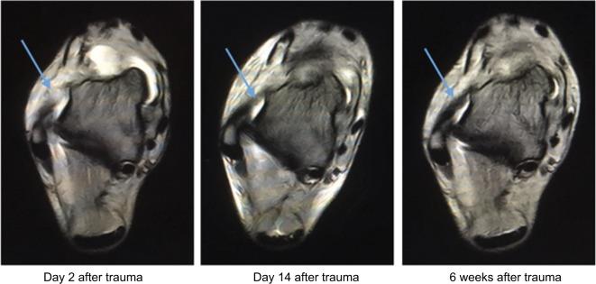 https://cdn.ncbi.nlm.nih.gov/pmc/blobs/4bdb/6011884/637208ec6471/mder-11-205Fig4.jpg
