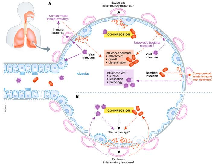 https://cdn.ncbi.nlm.nih.gov/pmc/blobs/4bdb/7338802/34e5a6045836/EMMM-12-e12560-g001.jpg