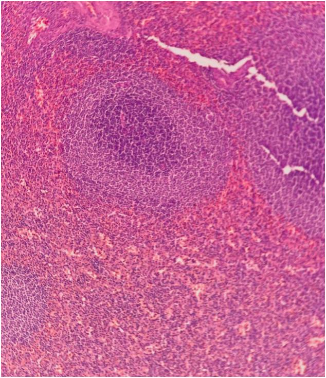 https://cdn.ncbi.nlm.nih.gov/pmc/blobs/4bdc/8178097/450cecc8a202/gr4.jpg