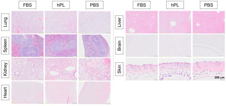 https://cdn.ncbi.nlm.nih.gov/pmc/blobs/4be3/11120611/2b7fc4fccc88/cells-13-00847-g005.jpg
