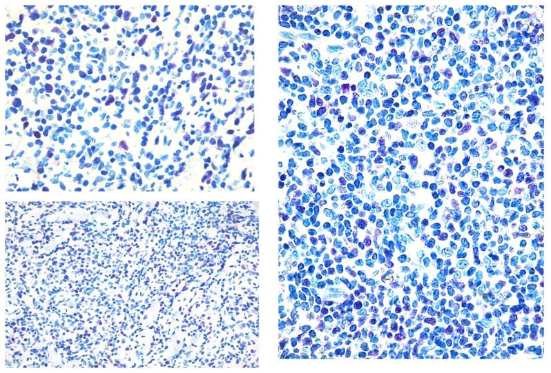 https://cdn.ncbi.nlm.nih.gov/pmc/blobs/4bee/9316398/de6e2278b122/diagnostics-12-01582-g002.jpg