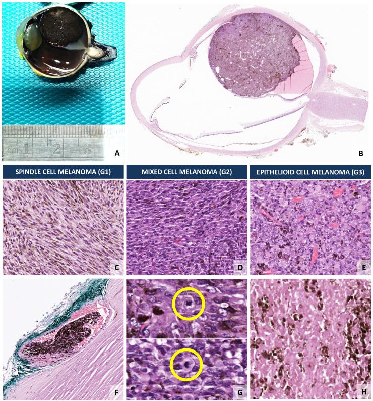 https://cdn.ncbi.nlm.nih.gov/pmc/blobs/4bf4/8749988/c3b2ebf7c9db/cancers-14-00096-g002.jpg