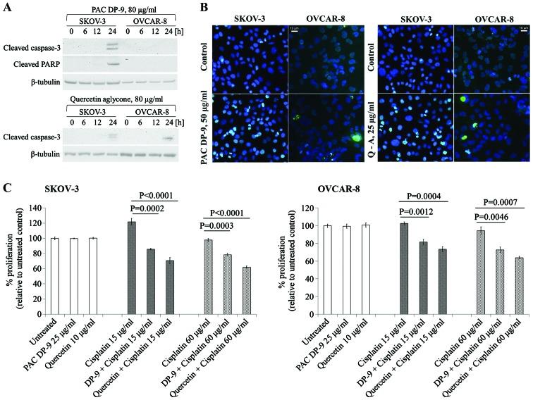 https://cdn.ncbi.nlm.nih.gov/pmc/blobs/4bf6/4383025/d68c945d3a33/IJO-46-05-1924-g02.jpg