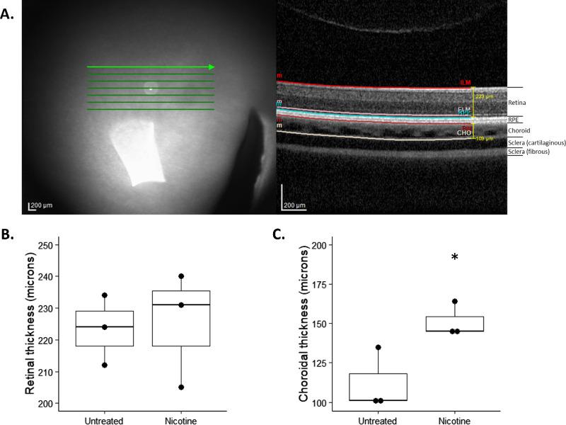 https://cdn.ncbi.nlm.nih.gov/pmc/blobs/4bfa/11412605/daa899b68e2d/iovs-65-11-29-f002.jpg