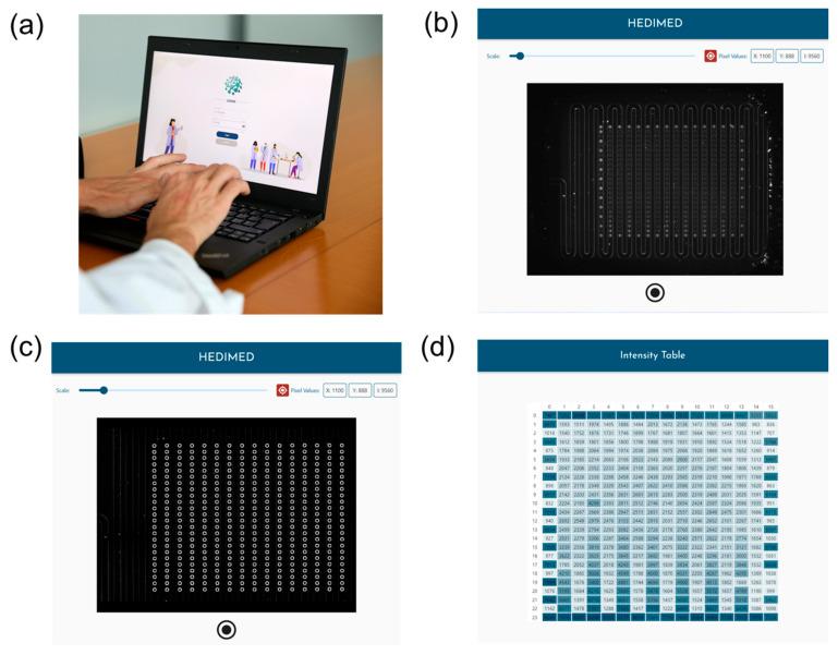https://cdn.ncbi.nlm.nih.gov/pmc/blobs/4bfc/11174465/078cd8dbd64f/sensors-24-03280-g003.jpg