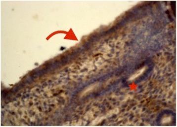 https://cdn.ncbi.nlm.nih.gov/pmc/blobs/4c07/5615471/3f64ee363031/12905_2017_438_Fig5_HTML.jpg