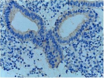https://cdn.ncbi.nlm.nih.gov/pmc/blobs/4c07/5615471/db55a9d1bd1b/12905_2017_438_Fig3_HTML.jpg