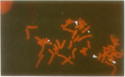https://cdn.ncbi.nlm.nih.gov/pmc/blobs/4c09/44400/2b49ea4096fe/pnas01137-0662-b.jpg