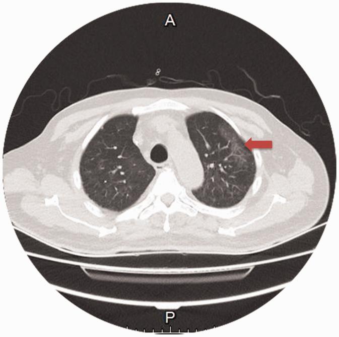 https://cdn.ncbi.nlm.nih.gov/pmc/blobs/4c09/9237926/3fd5aaa66e6a/10.1177_03000605221105358-fig2.jpg