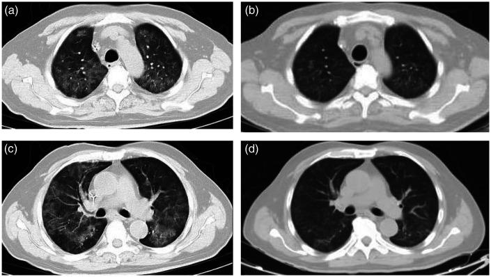 https://cdn.ncbi.nlm.nih.gov/pmc/blobs/4c09/9237926/df7cfc2feacd/10.1177_03000605221105358-fig1.jpg