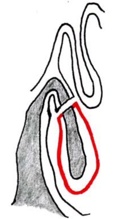 https://cdn.ncbi.nlm.nih.gov/pmc/blobs/4c0a/3199827/8d0230235bbe/CTO-09-03-g-003.jpg