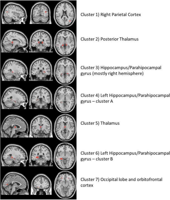 https://cdn.ncbi.nlm.nih.gov/pmc/blobs/4c0c/8822333/fc6c8e1236a2/fnagi-13-796067-g002.jpg