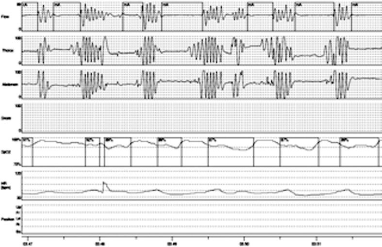 https://cdn.ncbi.nlm.nih.gov/pmc/blobs/4c12/4299164/4a7dfe41158c/1128-2460-33-100-g001.jpg