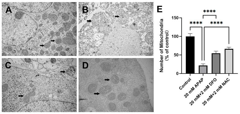 https://cdn.ncbi.nlm.nih.gov/pmc/blobs/4c16/12347875/05e0f6cdc7d7/ijms-26-07585-g002.jpg