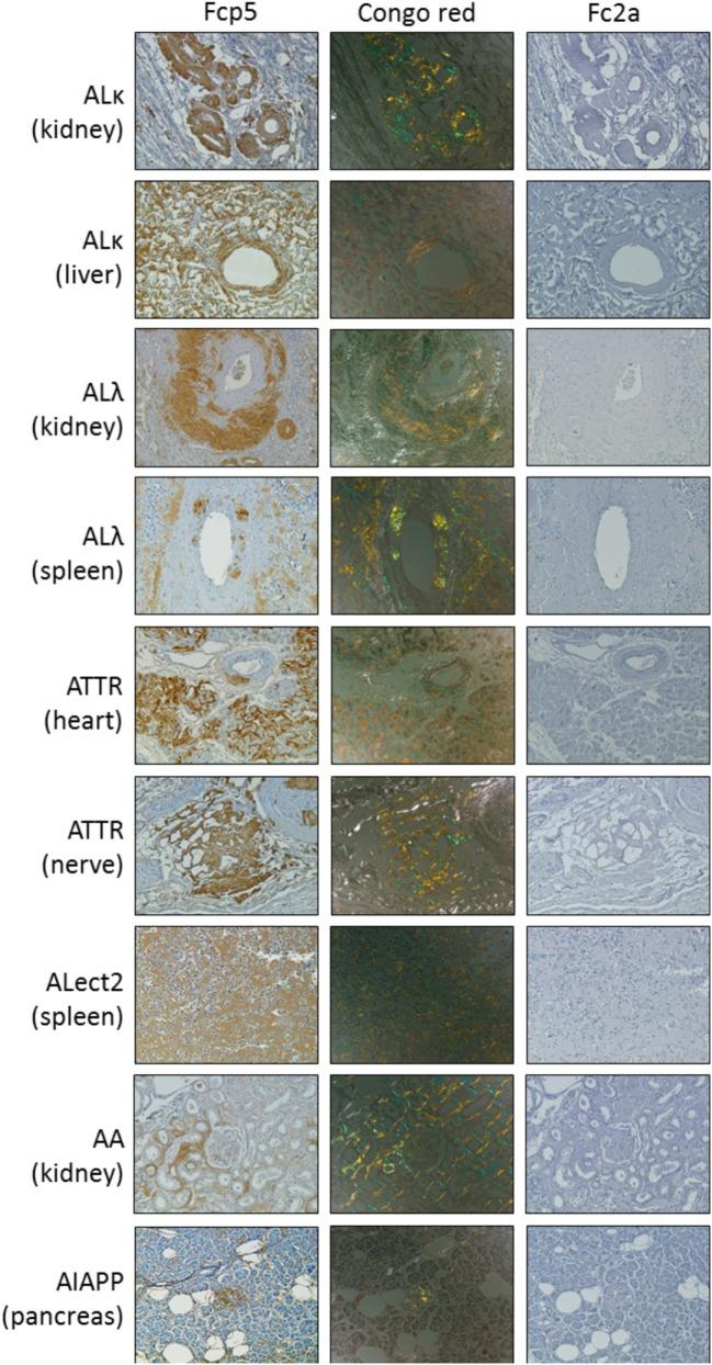 https://cdn.ncbi.nlm.nih.gov/pmc/blobs/4c17/5591422/06fd56975946/fimmu-08-01082-g003.jpg