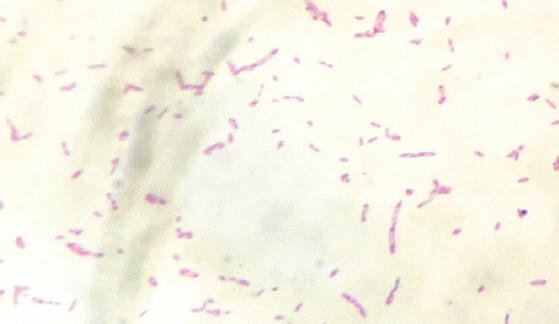 https://cdn.ncbi.nlm.nih.gov/pmc/blobs/4c1a/12064257/cffcca62d4fa/JOCR-15-70-g005.jpg